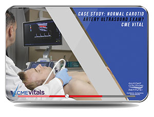 Case Study: Normal Carotid Artery Ultrasound Exam?
